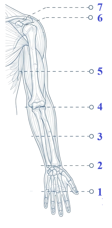 Niveaux d'amputation du membre supérieur — de 1 (partielle main) à 7 (inter-scapulo-thoracique)